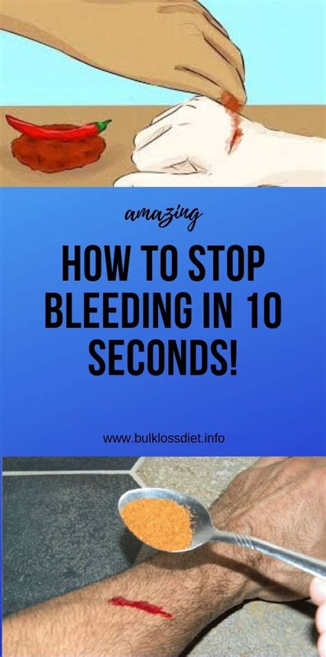 best way to stop bleeding.